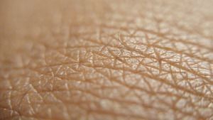 Tratamiento dermatitis seborreica en Valladolid Tratamiento dermatitis seborreica en Valladolid